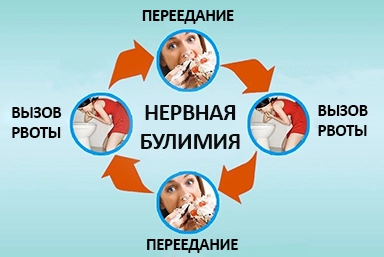 Лечение булимии в Чанах